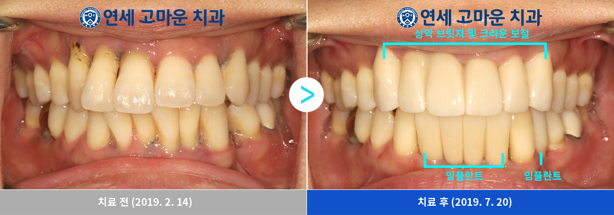 85eb4b345c211523bdaf09afbf2cdbc2_1770345318_5012.jpg 85eb4b345c211523bdaf09afbf2cdbc2_1770345318_5012.jpg