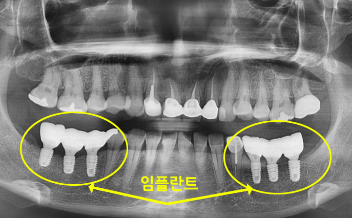 56dd3d9a76235b9dcc1773e1d6636e8d_1788752585_852.jpg